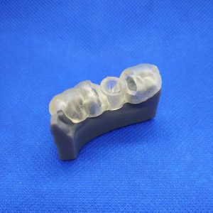 Technologia SLA-Żywica Grey+Żywica Dental SG-Model uzębienia pacjenta z szablonem implantologicznym